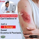 Herbal Harmony Soap for Balanced Skin